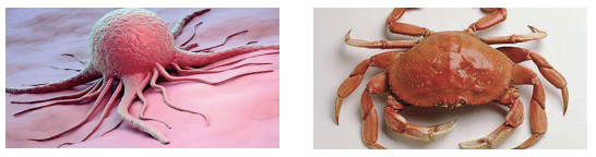 癌症-每个人体内都有癌细胞吗？-